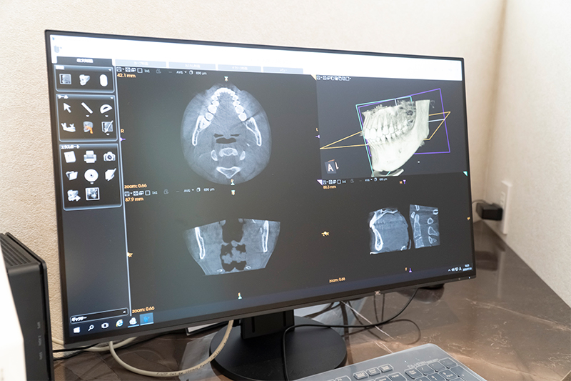 歯科用CT